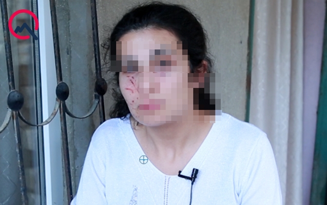 Bakıda zorlanmadan son anda qurtarılan qadın danışdı