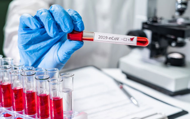 Daha 336 nəfərdə koronavirus aşkarlandı, 5 nəfər öldü