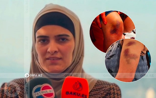 “Silahı başıma dirədi”