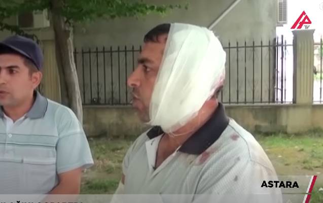 “Bir də gördüm, qulağım yoxdur…”