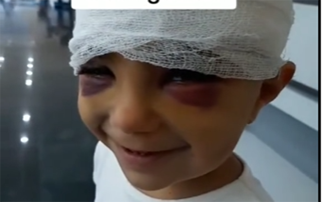 Azyaşlı qızı vurub qaçan moped sürücüsü tutuldu