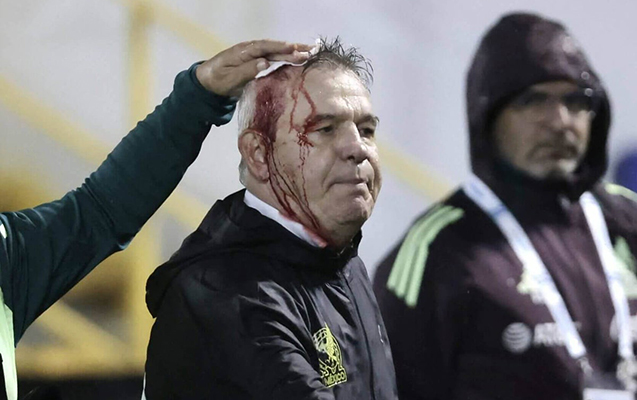 Pivə qutusu ilə baş məşqçinin başını yardılar