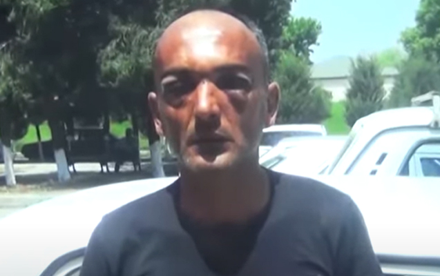 Toya gedən şəxs döyüləndən 9 gün sonra ölüb