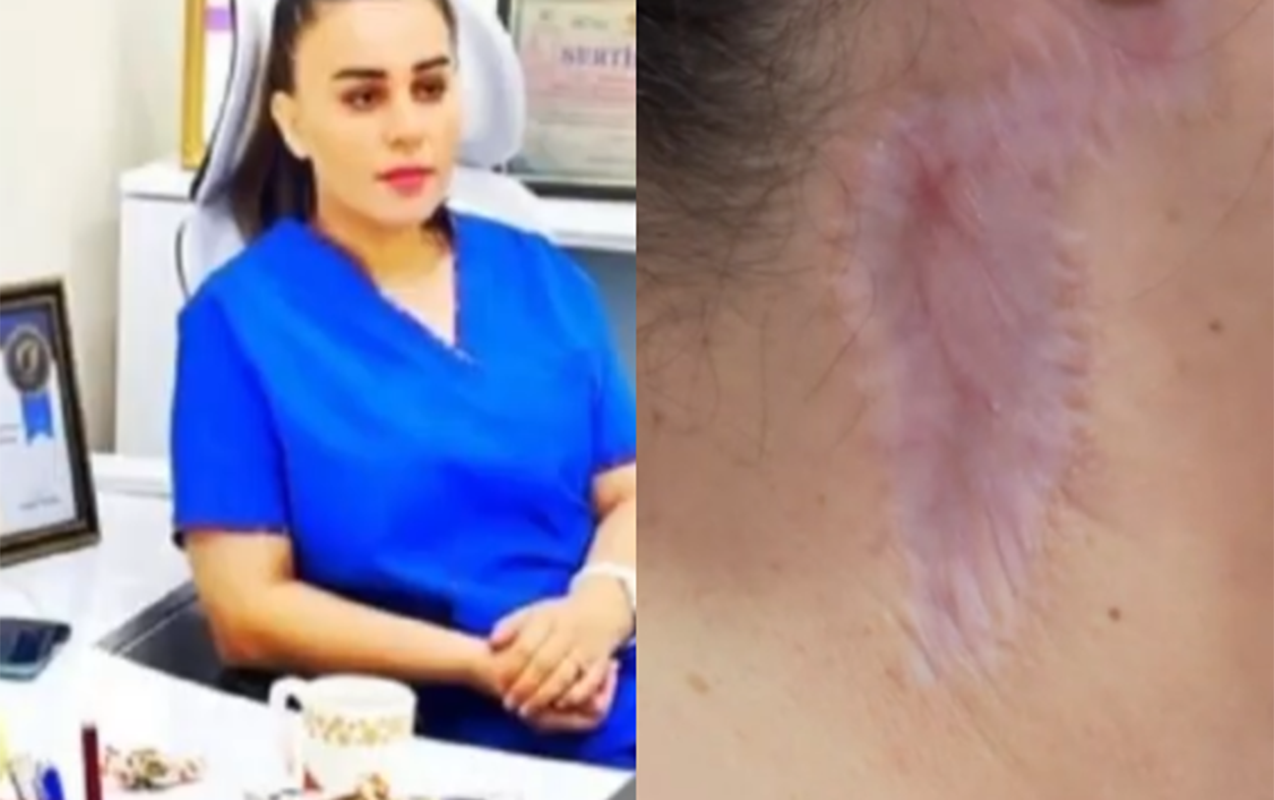 meni-gozellik-salonunda-emeliyyat-etdi-agzim-eyilir